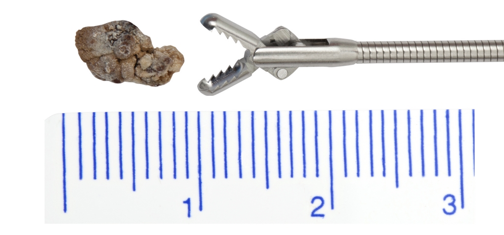 Pinca 7Fr Semirrigida 370mm para Retirada de Corpo Estranho, Duplo J e Biopsia