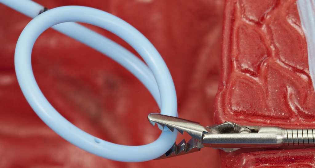 Pinca 7Fr Semirri?gida Boca de Jacare para Corpo Estranho e Duplo J